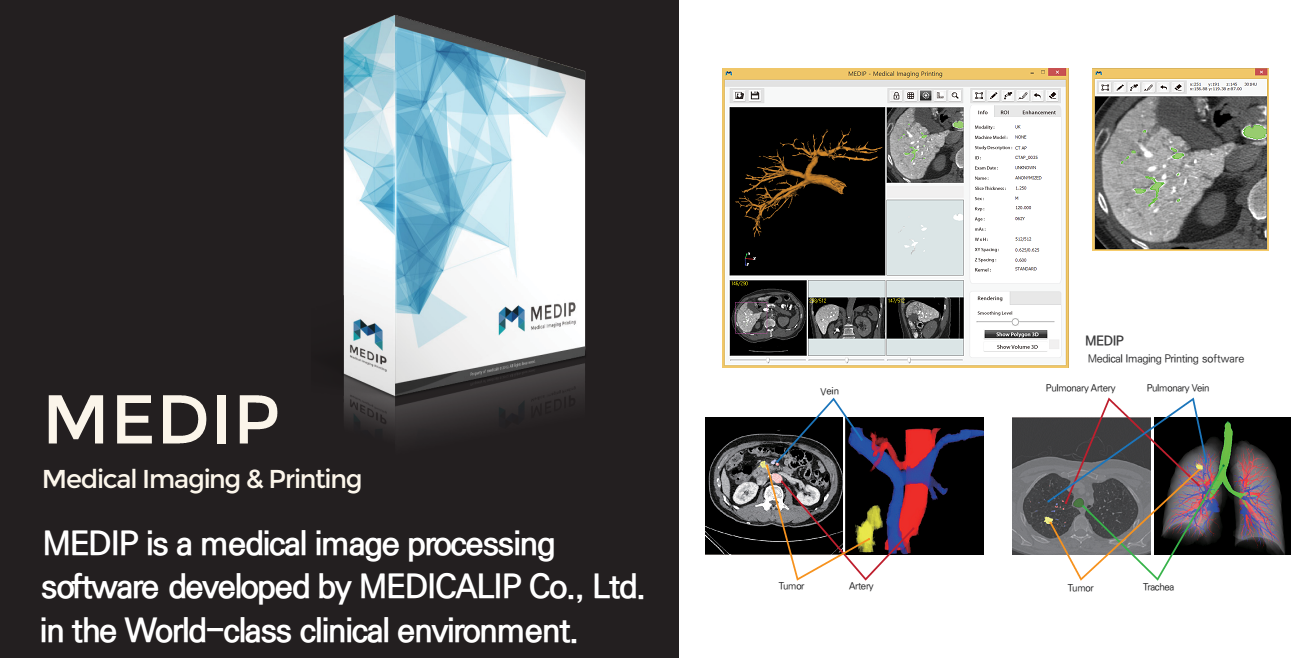 Medical Image Processing SW - MEDIP (Medical Imaging & Printing) IMAGE