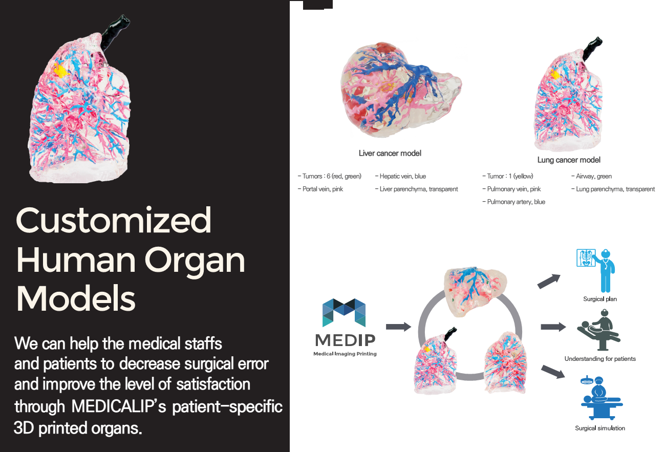 Patient-specific 3D Printed Organs IMAGE